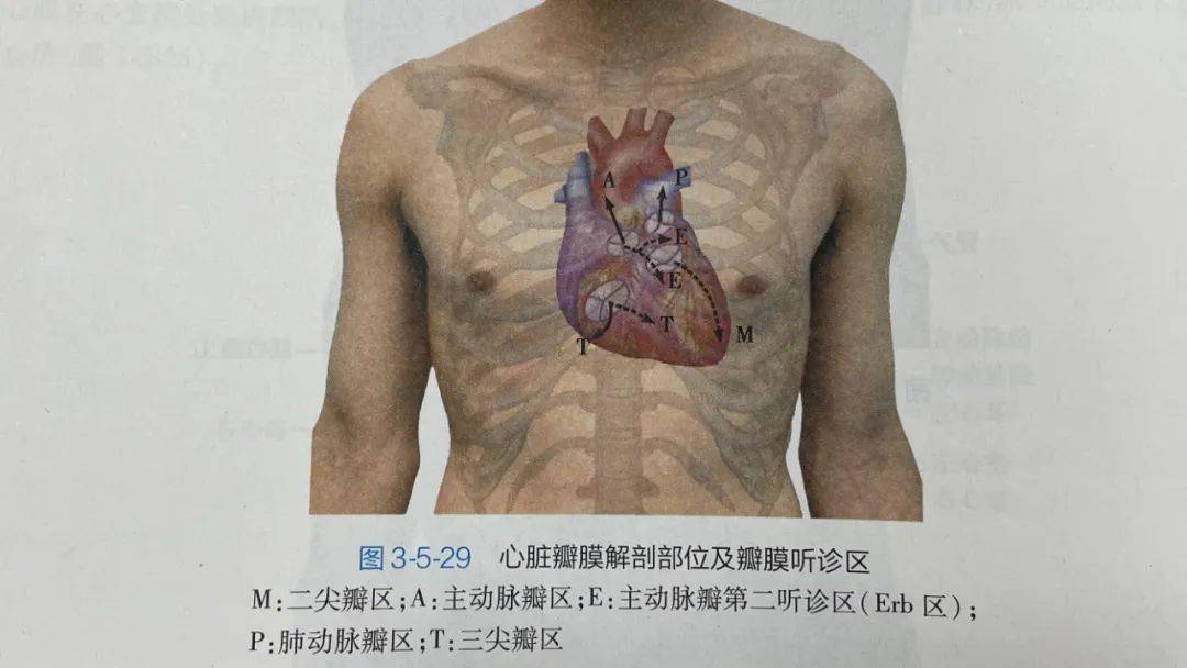 支气管|中年女性不明原因咳嗽40年，听诊居然没有心跳？！