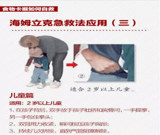 海姆立克急救法(heimlich maneuver),又名