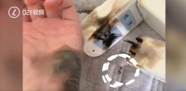 充电|女子拔插头引发爆炸，手掌黑了一大片！原因竟是……