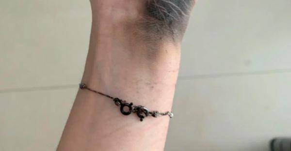 充电|女子拔插头引发爆炸，手掌黑了一大片！原因竟是……