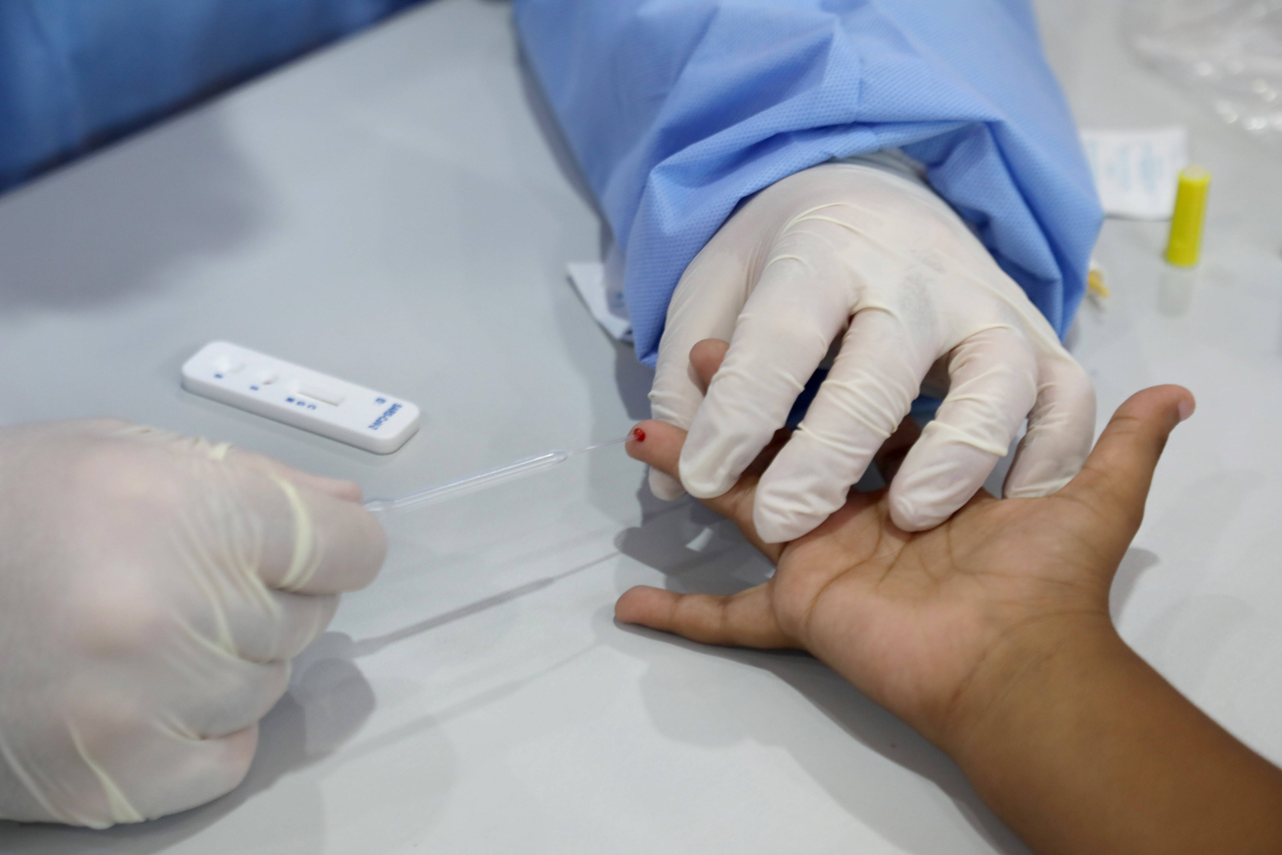 以色列开始为3岁至12岁儿童检测新冠抗体