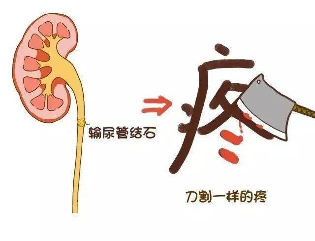 问题就大了,比如肾结石但要是长错了地方,待在了不该待的地方再不济