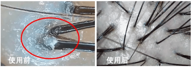 洗头|脱发、秃头，又丑又显老！这样做，头发浓密，更显年轻好气质