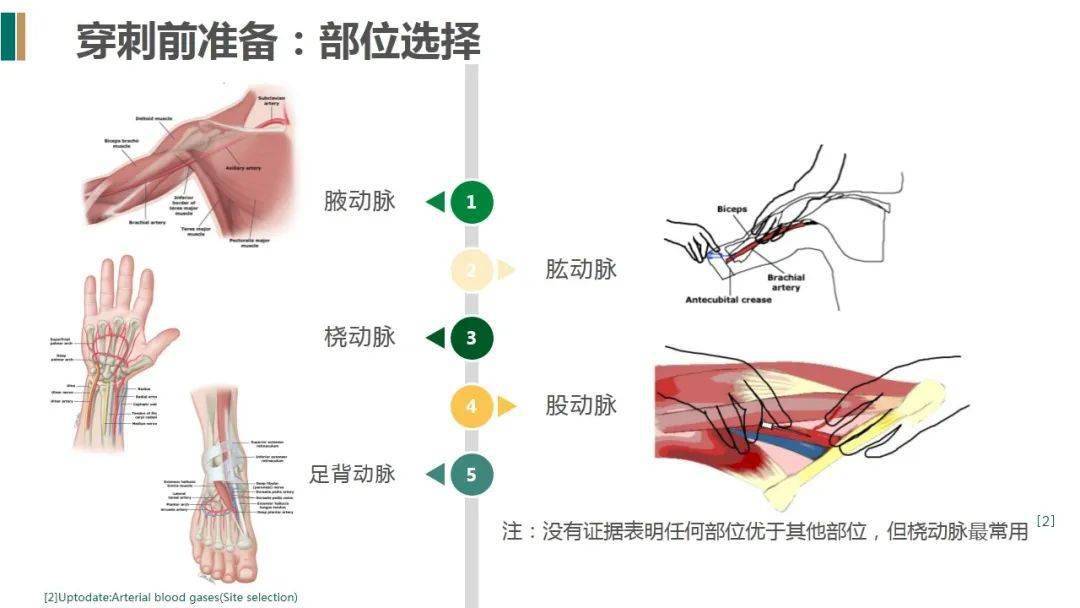 【ppt】有創動脈血壓監測的護理(附具體操作精彩視頻)