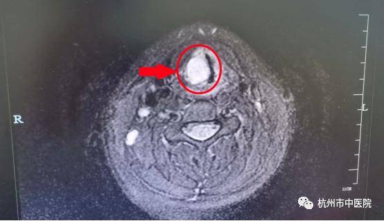 身心状态|浙江14岁少女“突遭横祸”！怎么会……