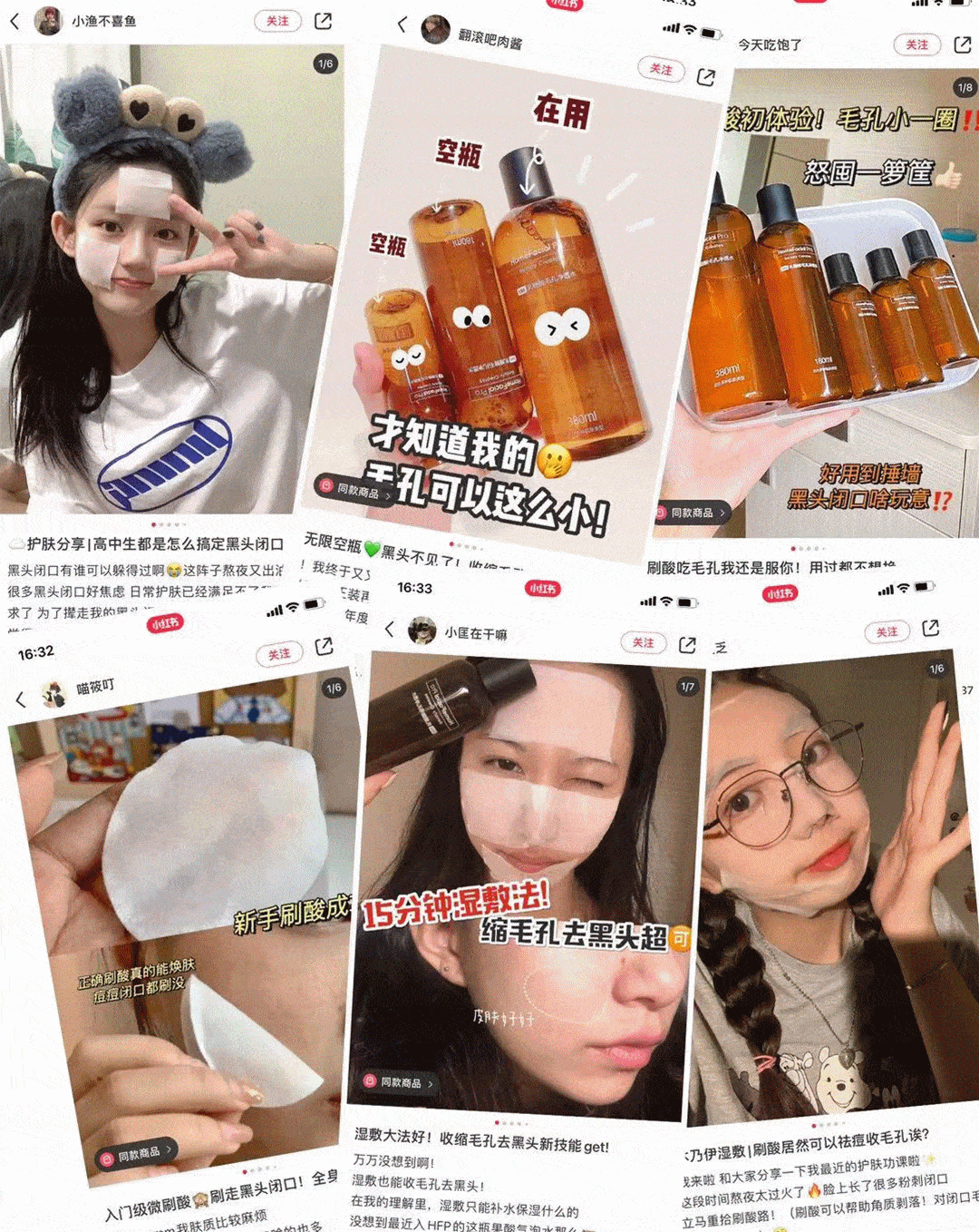 黑头|阿娇没骗我！2块钱敷一次酸，脸上“小疙瘩”竟被吞了！