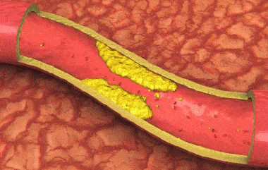 03fe4c4d44dd4a7981ccce14fde182a5.gif