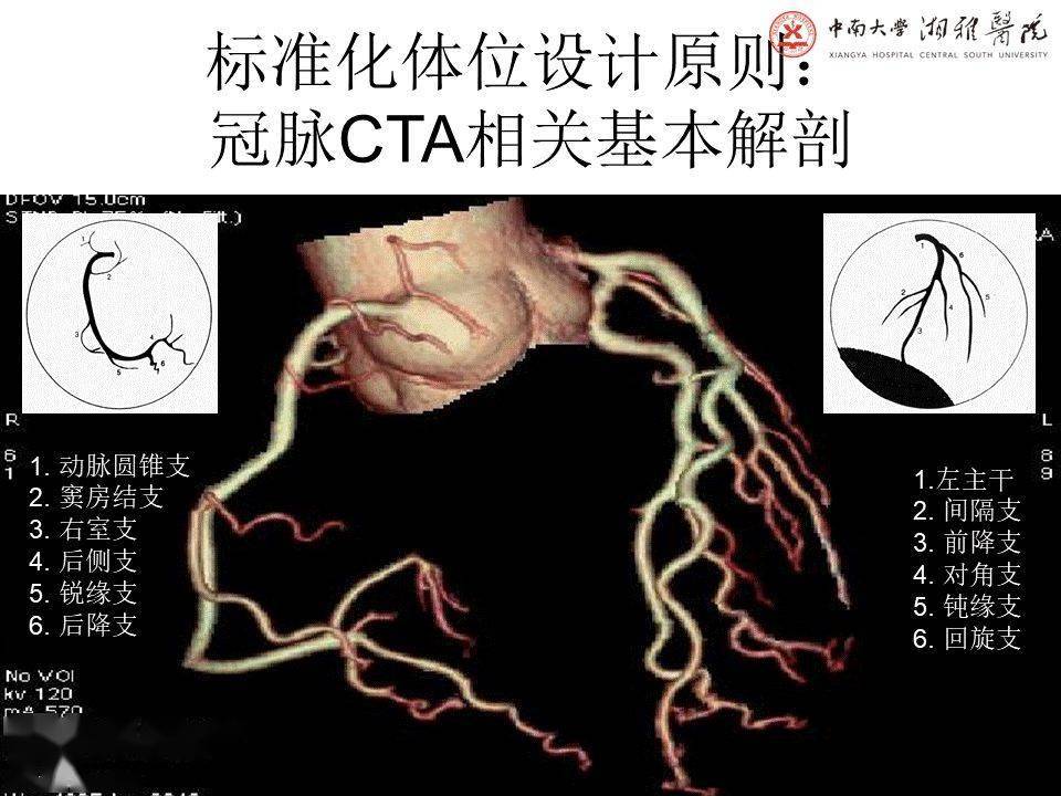 湘雅冠脉cta标准化后处理及规范化报告