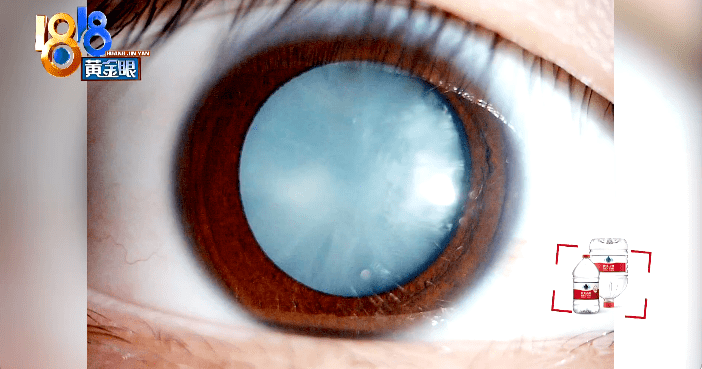 因为|最伤孩子胃的不是炸鸡,不是奶茶,而是这3种食物……