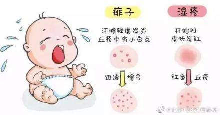 颈部|如何鉴别孩子起的是湿疹还是痱子？
