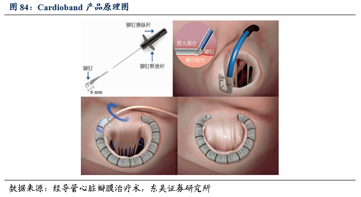 三尖瓣成形术图片