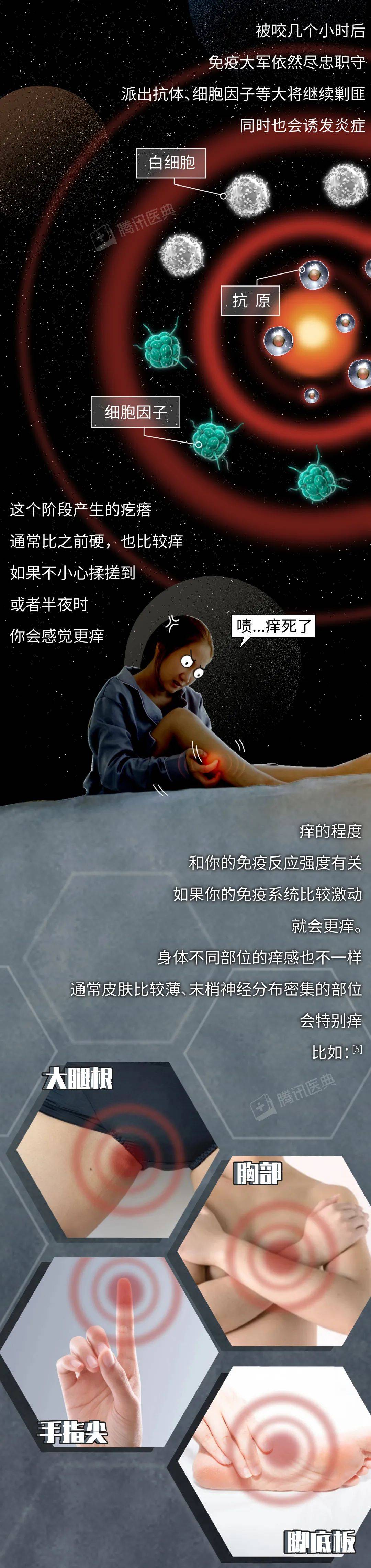 评论|被蚊子咬了，再痒也别挠，教你3招马上止痒