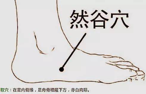 糖尿病在中医上称为"消渴".