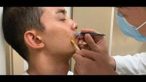 脸部|吴磊拍马战戏时脸部意外被炸伤 坚持拍完才赴医院包扎