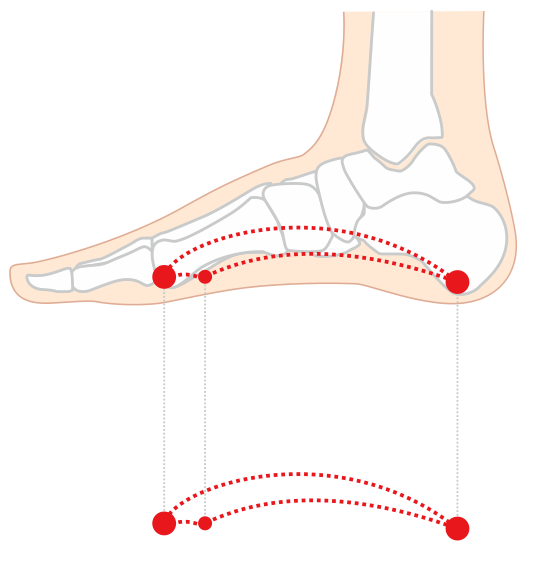 足弓图示意图图片