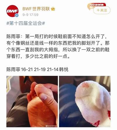 陈雨菲比赛时脚被李宁鞋划伤 品牌紧急回应同款下架(图1)