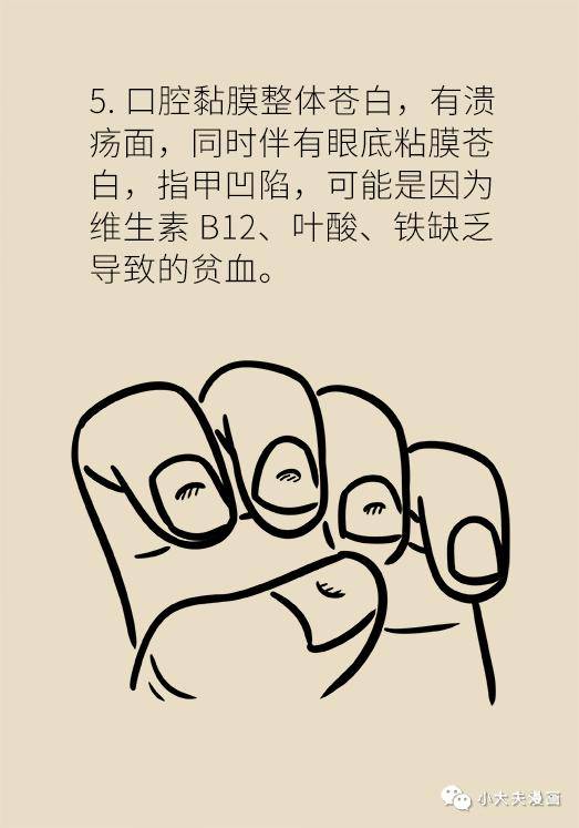 版权|口腔溃疡反复发作可能是大病先兆，快去这些科室检查