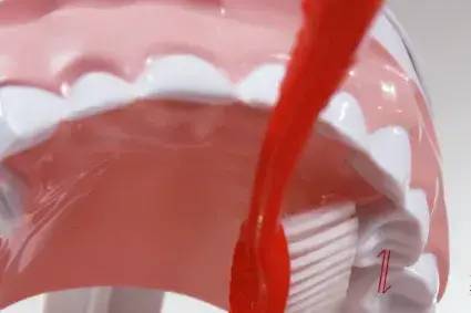 图片|5岁男孩突发急性肾炎，病根竟然是在口腔里