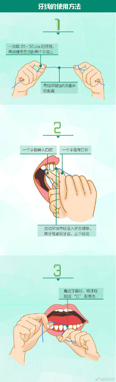 新闻|护牙有招~这些“小神器”快来了解