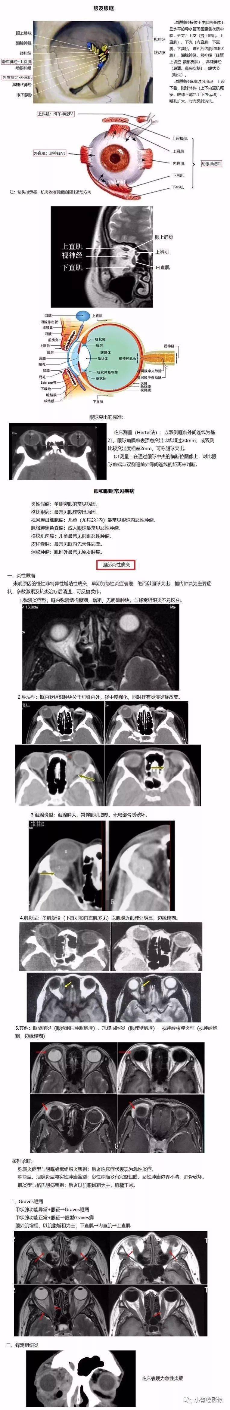 一圖掌握:眼和眼眶常見病影像診斷