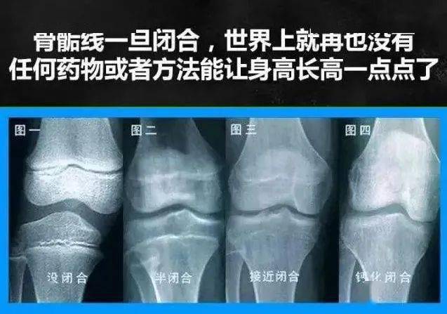 孩子13岁,吃了它,身高永远停在了1米4……_生长激素