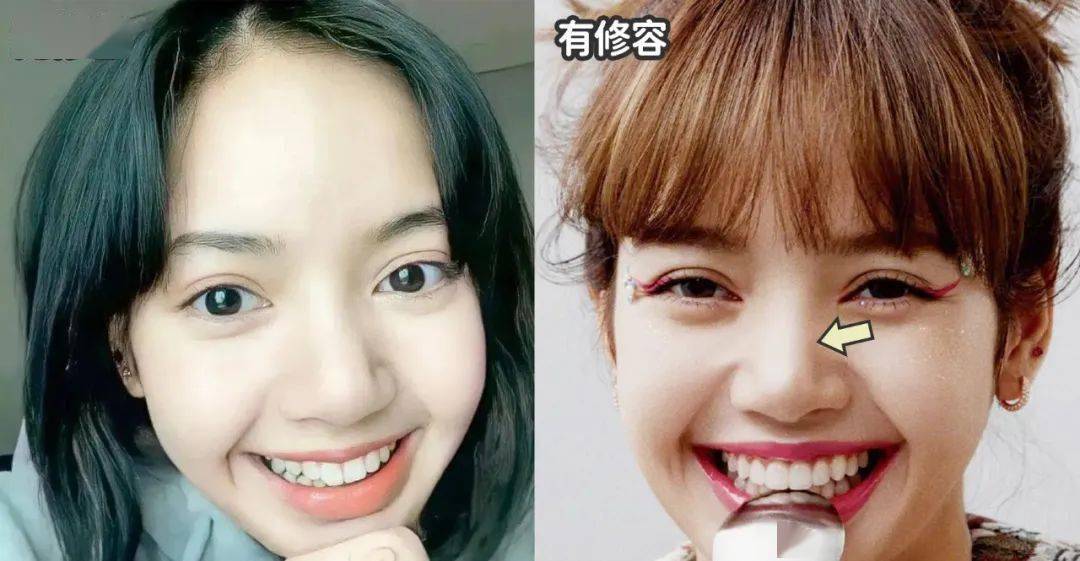 很多人说lisa调整过鼻子,但麦琪仔细看她现在的鼻头,如果脱离合适的