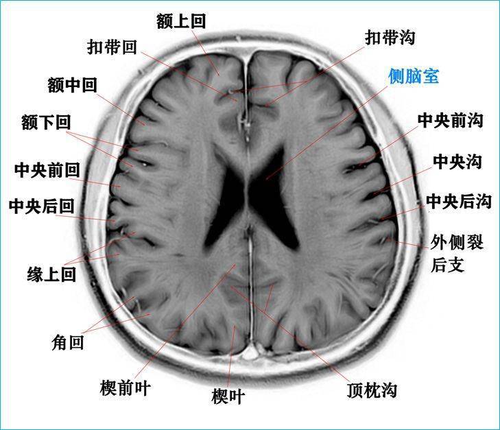 头颅CT解剖图图片