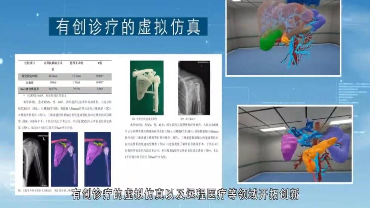智能化|新桥医院邀数字医学专家相约云端研讨
