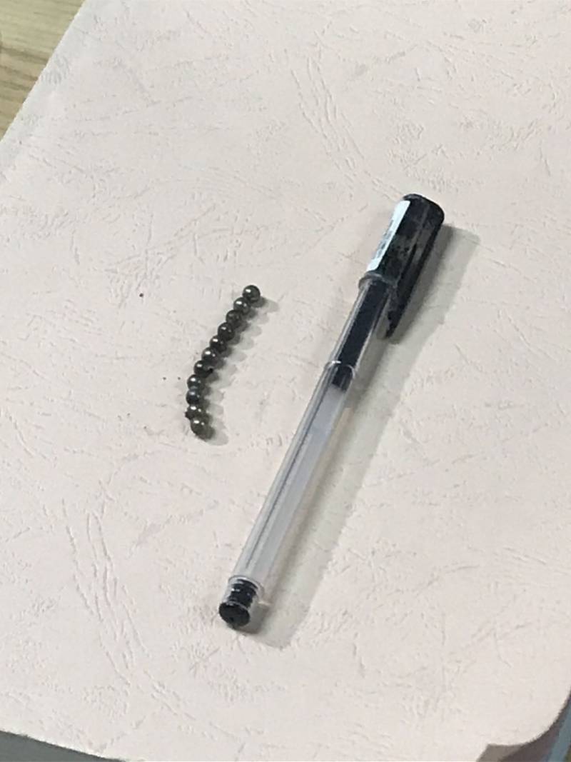 杨六成|别给孩子玩磁力珠！3岁男童误吞11颗磁力珠 致4处肠穿孔