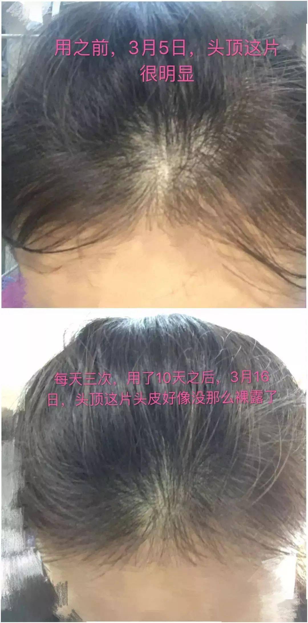 发型为了拯救发际线，日本人可是绞尽脑汁！