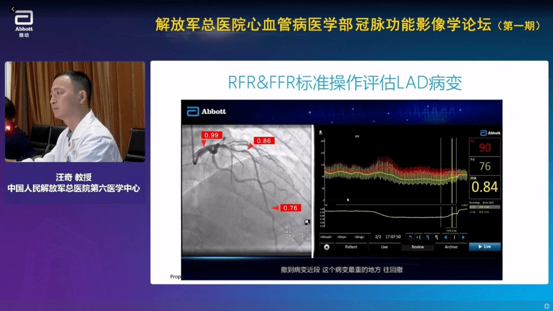 解放军总医院心血管病医学部冠脉功能影像学论坛第一期圆满落幕