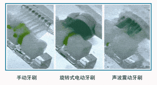 牙刷一个偷偷变美的小心机，只要一招好看十倍都不止！