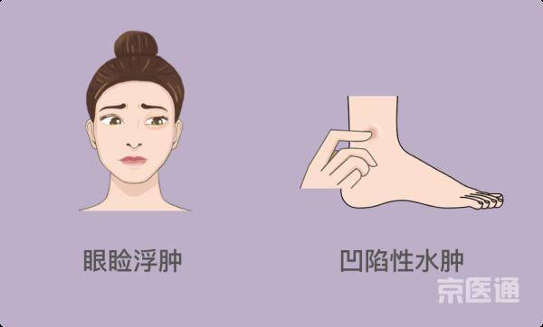 建议|脸上9个变化可能是病？一分钟教你对照自查