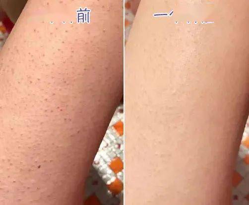 同事 阔腿裤烂大街了！入秋之后，这条裤子才是真时髦又显瘦！