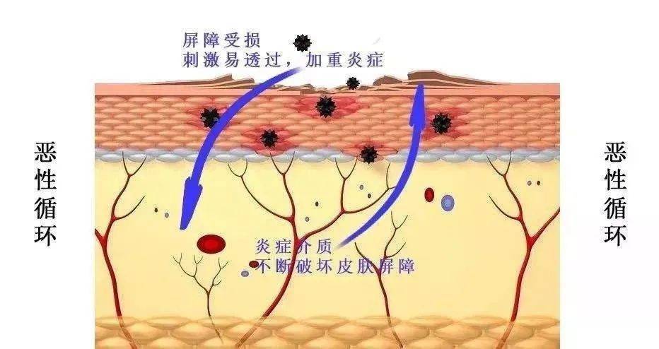 屏障护肤行业真大佬：全国皮肤科第一，一个面霜做3年，有多好用？