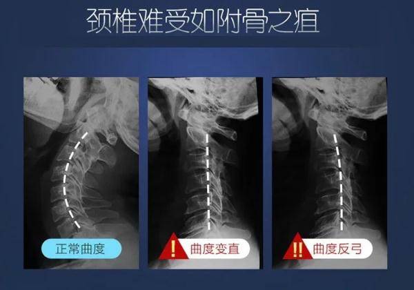 冯智英|“我想拧掉脑袋！”杭州15岁学霸一刷题就头痛欲裂！医生：这个习惯太差了，家长一定要看