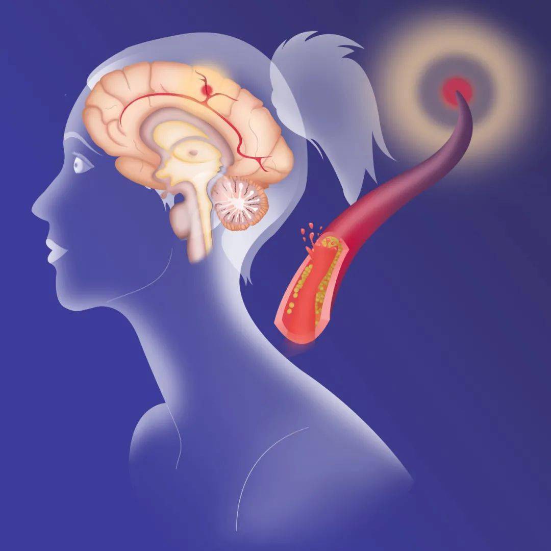 血液|八大糖尿病并发症的预防措施汇总，分享给您