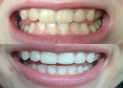 市民|@大连人！看牙消费福利券正在发放，符合条件的均可领取