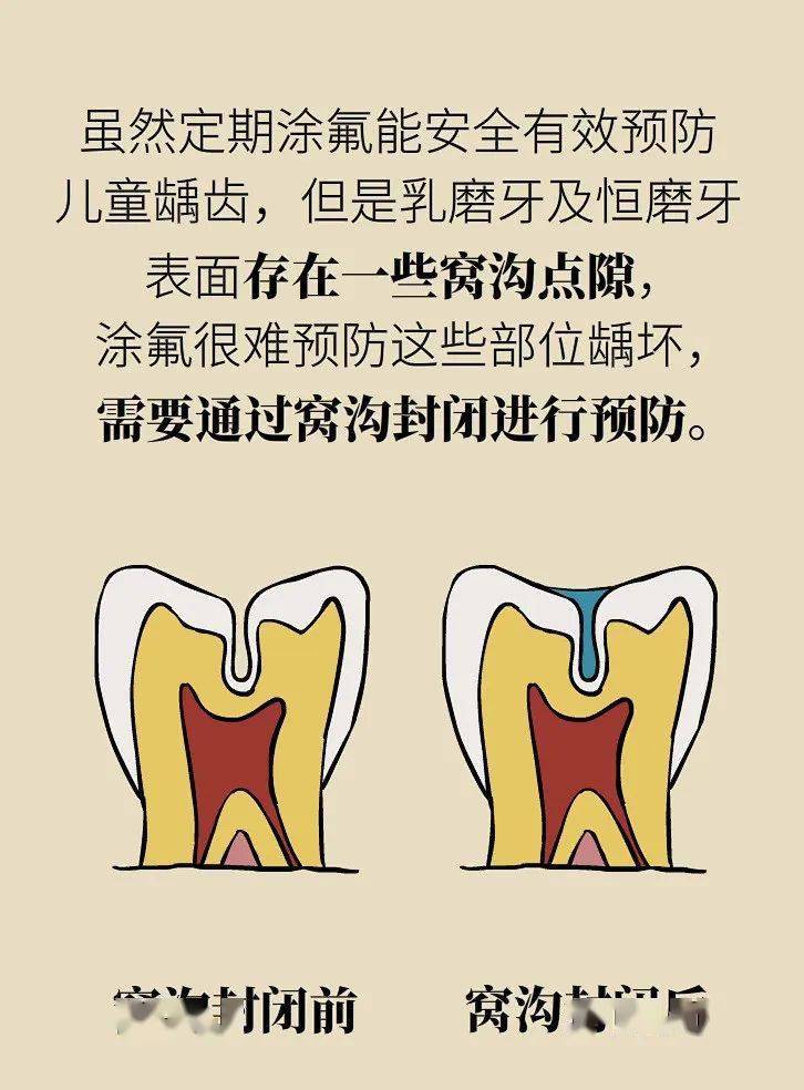 宝宝龋齿怎么办图片