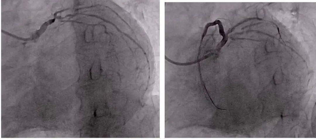 严重|引以为戒！专家提醒：这种情况千万别硬扛