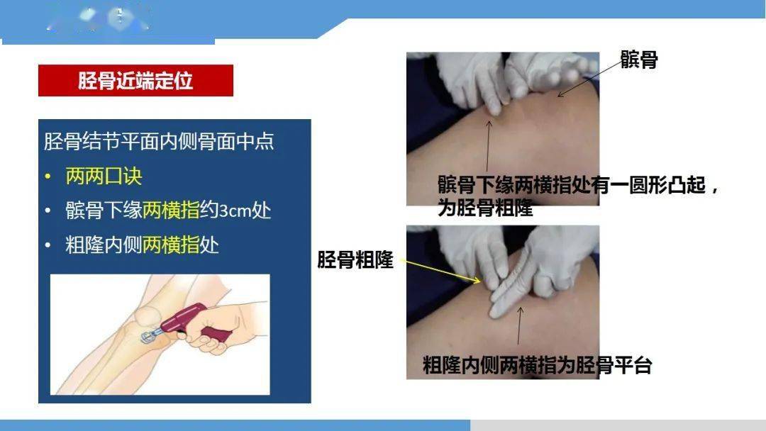 ppt永不塌陷的生命通路骨髓腔輸液技術