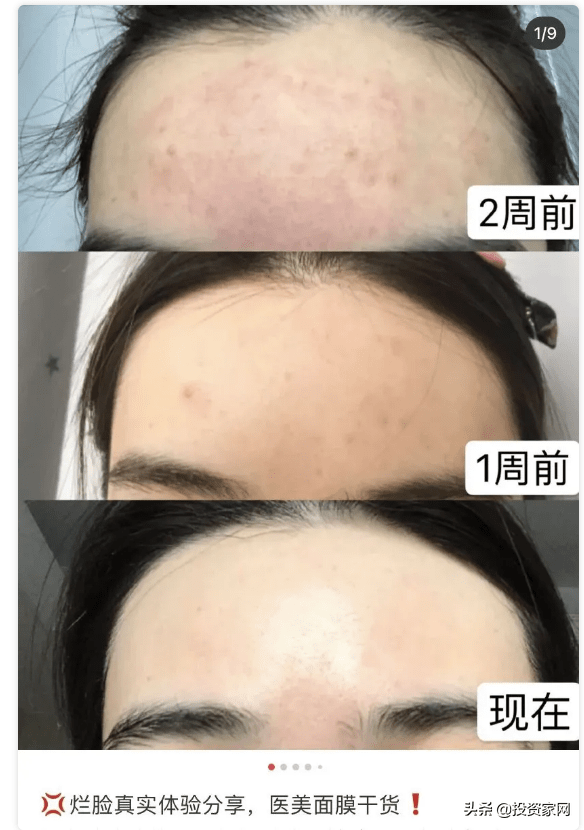 敷尔佳2人研发做出6亿利润 年轻女孩的钱有多好骗(图7) 敷尔佳2人研发做出6亿利润 年轻女孩的钱有多好骗(图7)