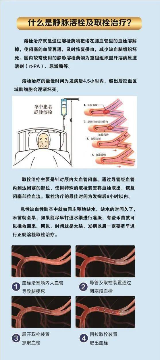曙光预告警惕卒中症状尽早识别救治曙光医院卒中中心将