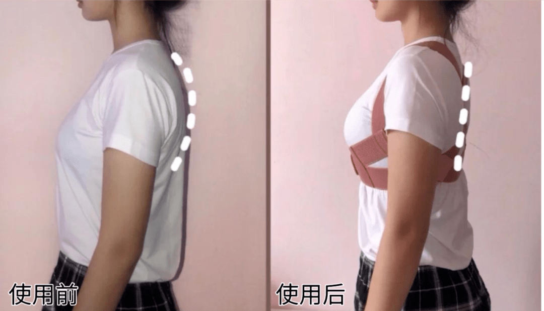 女生驼背vs不驼背穿同一件衣服差距到底有多大