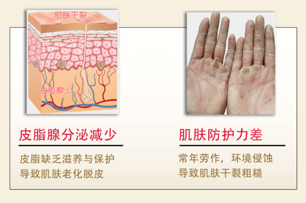 的表面百肤邦马油面霜两件立减20元，维E尿素霜两件立减6元！限时加赠橄榄油唇膏！滋润一整个秋季！