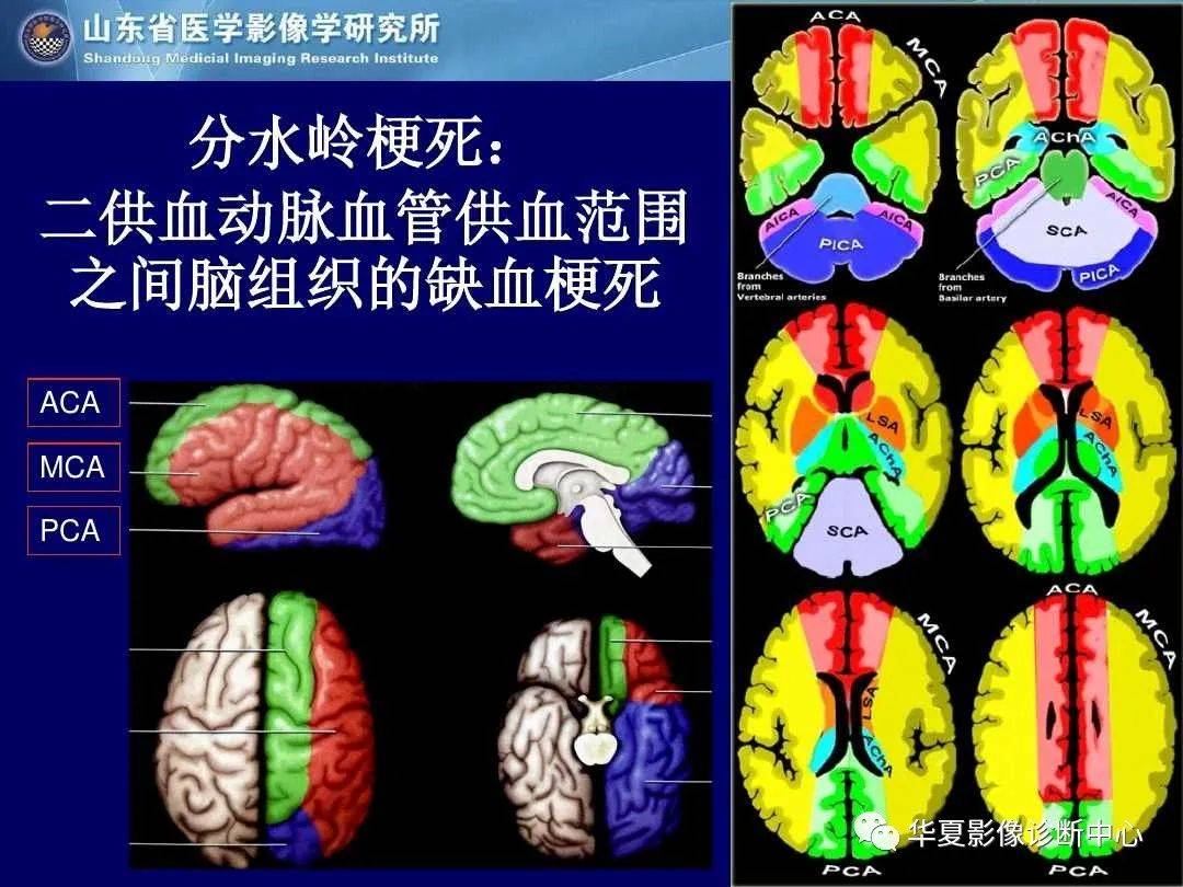 诊断|缺血性脑血管病的影像诊断