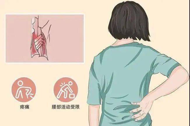 天寒诱发急性腰扭伤,第一时间应怎么处理?_腰部