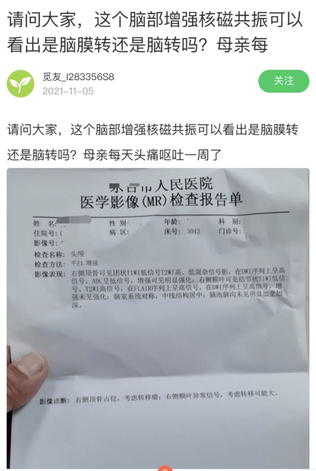 觅健互助 头痛呕吐一周,脑部增强核磁共振能看出是脑膜转还是脑转吗