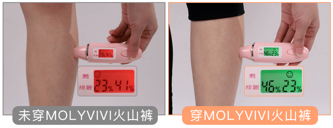 优惠 吴昕这次开挂了？从大象腿到女团腿她究竟做了啥？