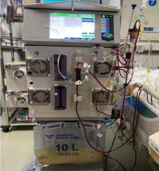 山药|53岁阿姨一顿吃了3斤牛肉+海参炖鸡，结果进了ICU！